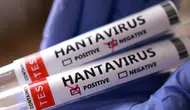 Hantavirüs Tartışmalarına Son Nokta! Türkiye’de Vaka Var mı?