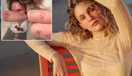 Farah Zeynep Abdullah’ın Son Hali Korkuttu! Vücudundaki Morluklar Şaşırttı
