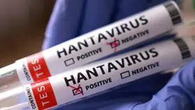 Hantavirüs Laboratuvar Ürünü Mü, Hantavirüs biyolojik silah mı?