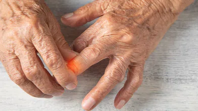 200'den Fazla Türü Olan Romatizmal Hastalıkların Gizemini Çözün: Neden Bu Kadar Çeşitliler ve Belirtileri Nelerdir?
