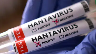 Hantavirüs Tartışmalarına Son Nokta! Türkiye’de Vaka Var mı?