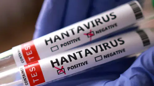 Hantavirüs Tartışmalarına Son Nokta! Türkiye’de Vaka Var mı?
