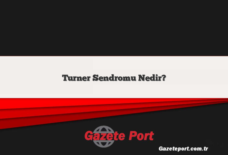 Turner Sendromu Nedir?