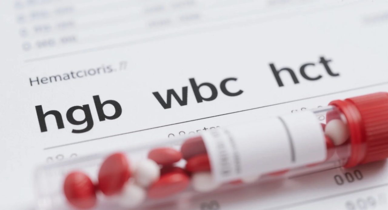 Kan tahlilinde hgb, wbc ve hct nedir
