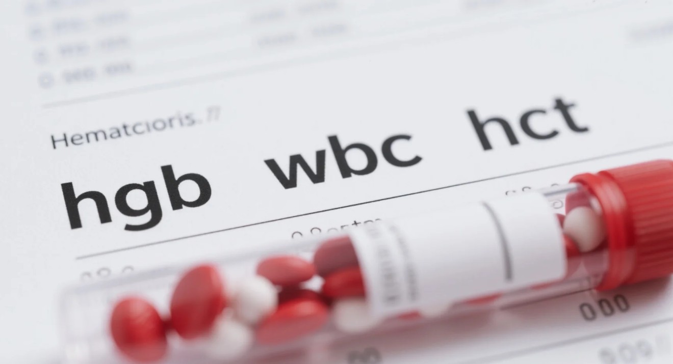 Kan tahlilinde hgb, wbc ve hct nedir? Değerleri, düşüklüğü, yüksekliği ve kanserle ilişkisi hakkında her şey
