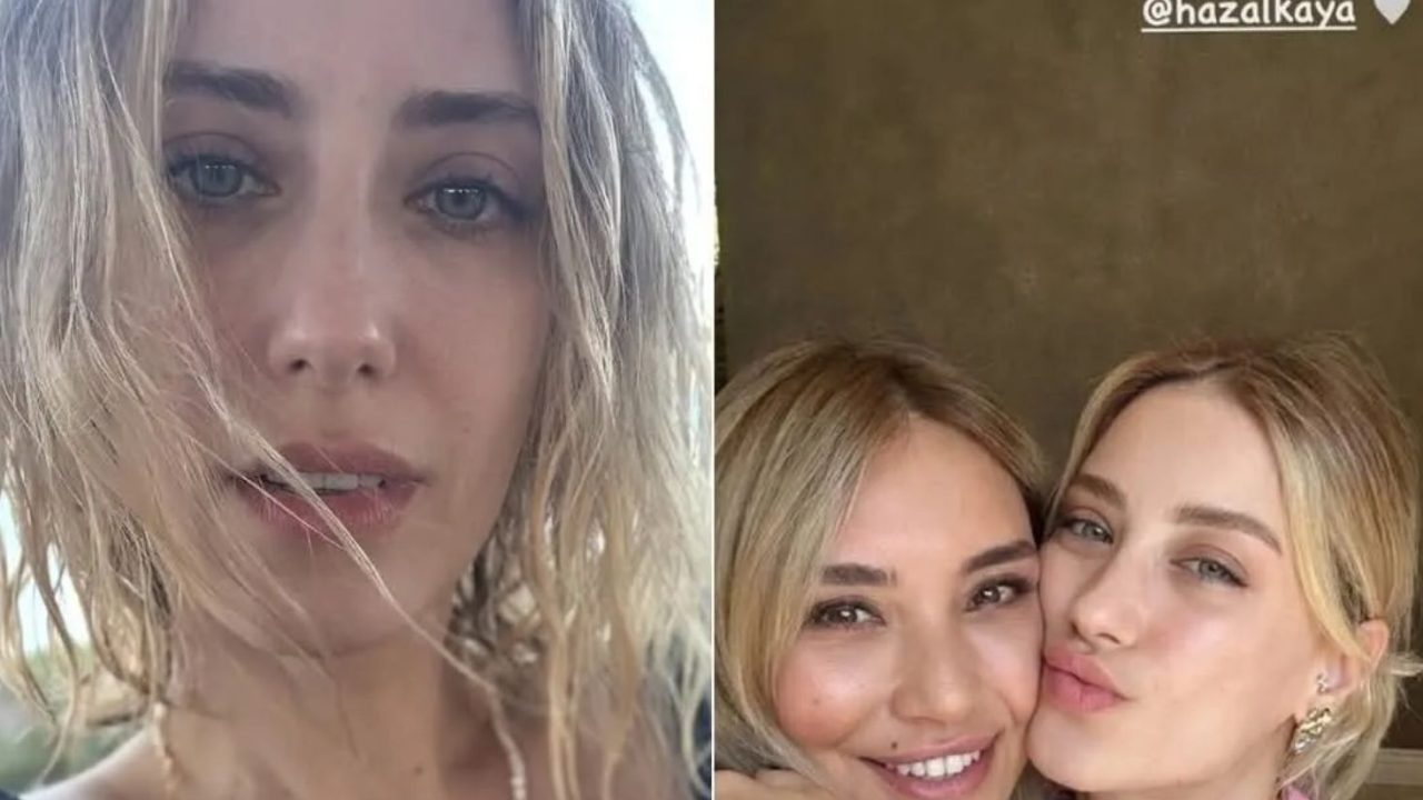 Hazal Kaya’nın Paylaşımı Gündem Oldu: Yüzündeki Değişim Estetik İddialarını Aleve Verdi