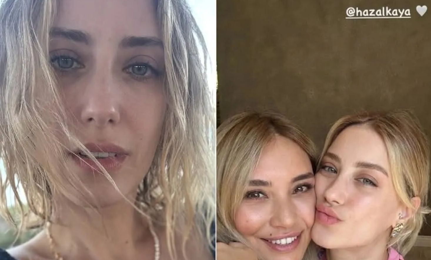 Hazal Kaya’nın Paylaşımı Gündem Oldu: Yüzündeki Değişim Estetik İddialarını Aleve Verdi