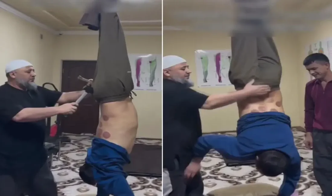 Sosyal medyada paylaşılan şok edici görüntüler, bel fıtığı tedavisi adı